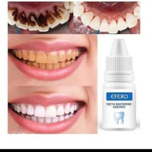Teeth whitening